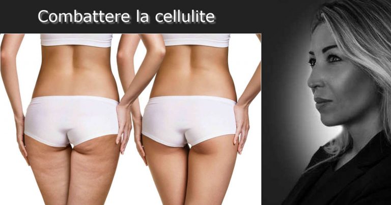 Combattere la Cellulite