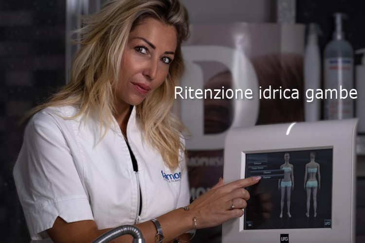 Ritenzione idrica gambe