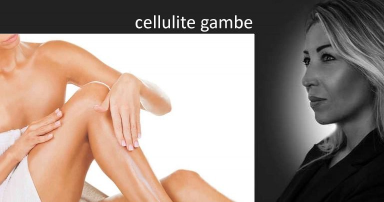 Cellulite Gambe